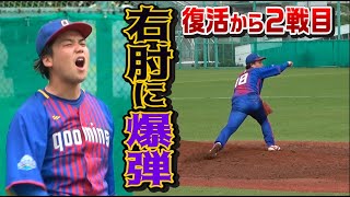 復活した14日後…若林のヒジに爆弾…力が入らなかった2試合目のマウンド