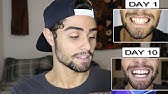 Lumist vs The Other Strip: Teeth Whitening Product Comparison - YouTube