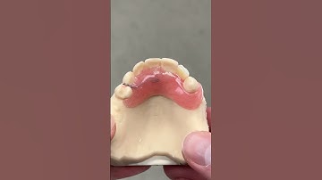 Flipper Partial with a Wire Clasp @EnvisiontecMain #envisiontec #lsk121shorts #dental #teeth