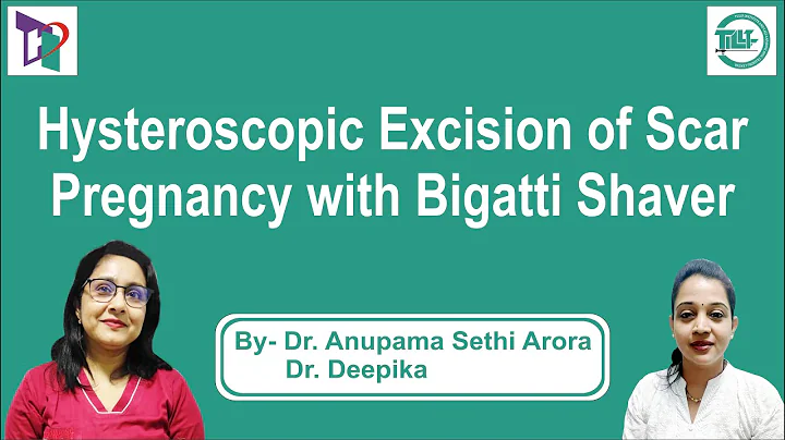 Hysteroscopy Excision of Scar Pregnancy with Bigat...
