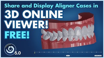 BSP5.0 Share and Display Aligner Cases in 3D Online Viewer. FREE!