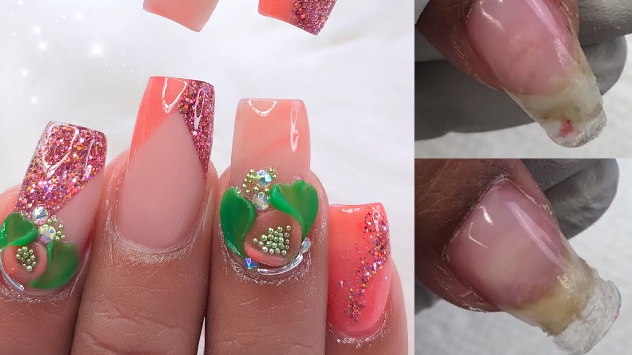 Nail Art/Acrylic Nail Fungus/ Como Prevenir el Hongo en Uñas Acrilicas -  thptnganamst.edu.vn