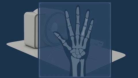 The Dangers of Templates in EHRs