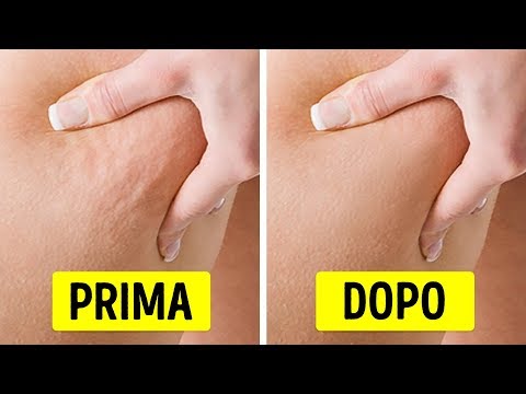 Video: Come sbarazzarsi della cellulite sul retro delle cosce (con immagini)