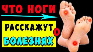 Симптомы болезни по ногам ► Могут ли ноги рассказать о заболеваниях? 11 признаков взаимосвязи