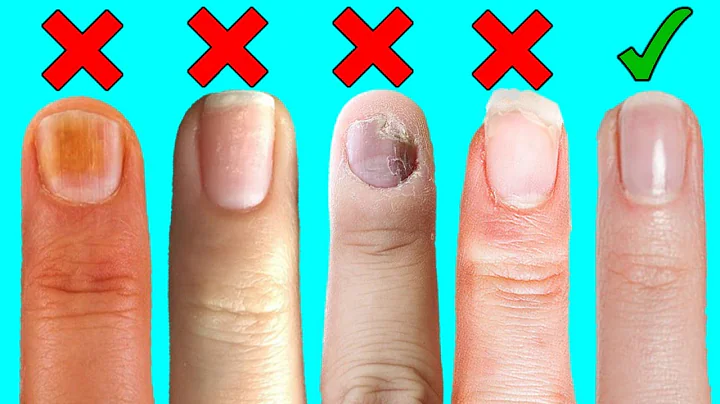 8 Things Your Nails Can Say About Your Health