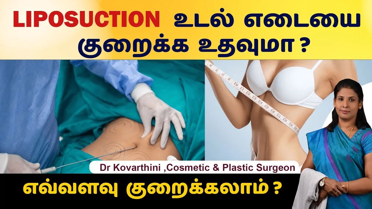 Is Liposuction for Weight Loss? 💉💪 Truth Revealed! Ko Cosmetic Surgery Centre