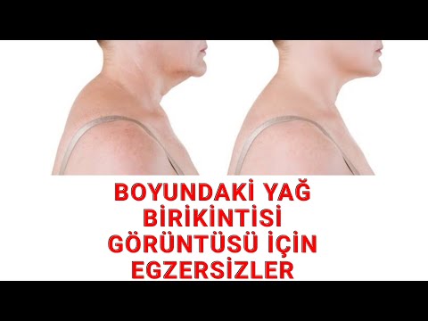 Video: Boyundaki Yağ Nasıl Kaldırılır