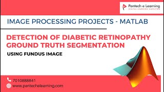 Detection of Diabetic Retinopathy Ground Truth segmentation using Fundus Image