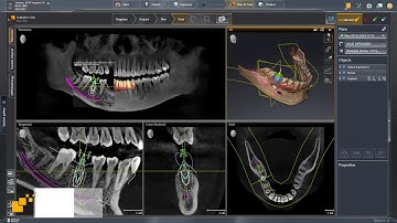 SICAT Implant 2.0 - Managing Plans