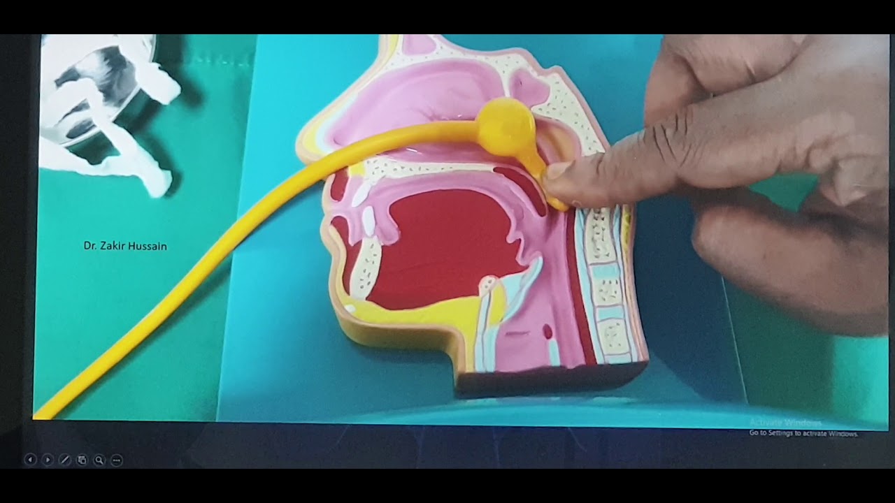 Nose bleed Part 6 (Hindi) Patient teaching programme