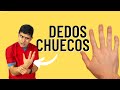 Dedos chuecos; Conserva la alineación de los dedos de tus manos