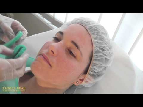 Video: Cómo aplicar el peeling de cultivo de la piel: 14 pasos (con imágenes)