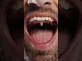 Qué es eso al final de tu boca? 😮👀  #xpresstv #datoscuriosos #curiosidades