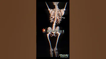 اذا يخطبني اسويله اكثر اغنيه عراقيه تضحك مالي خلق احط هاشتاقات 