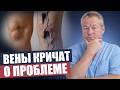 Варикозная сетка: как убрать ее навсегда без инъекций