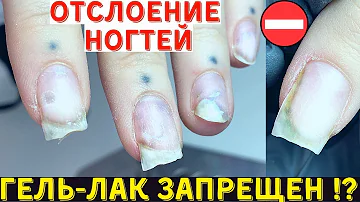 Почему нельзя часто делать маникюр