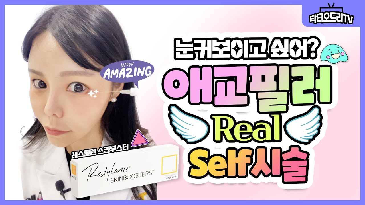 애교필러 리얼 셀프시술! 역시 애교에는 레스틸렌필러가 최고죠?!^^