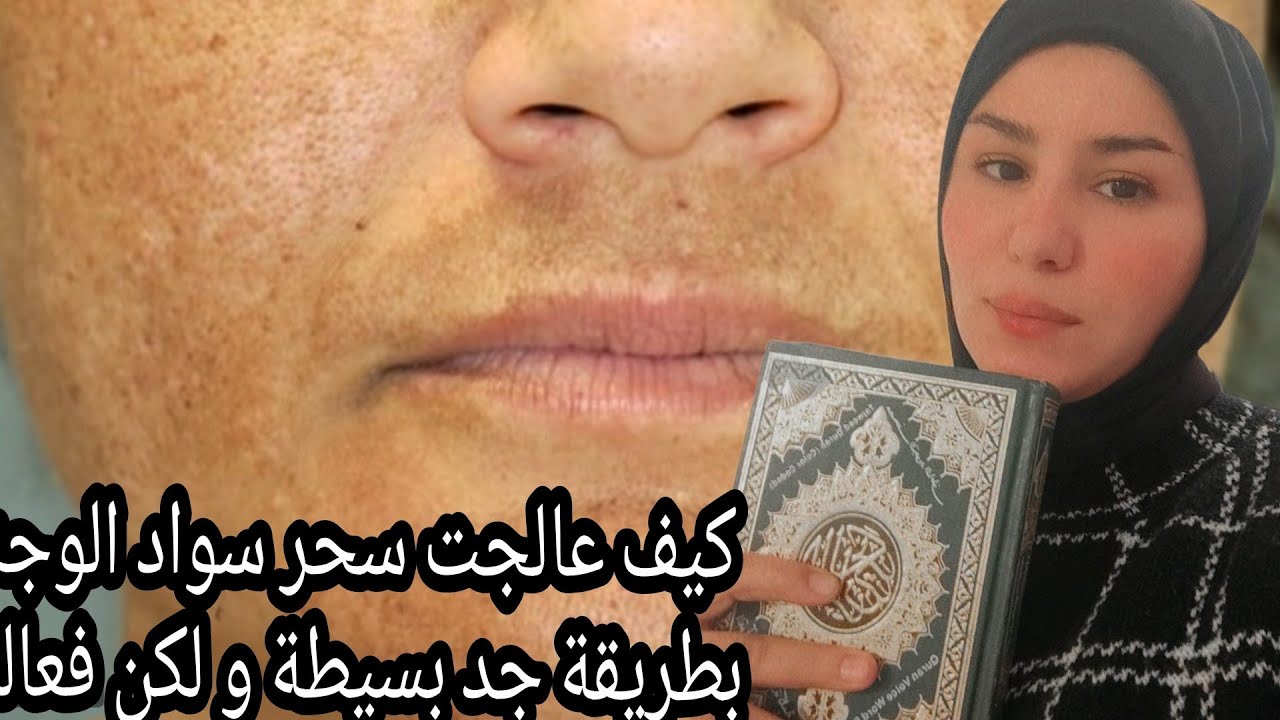 بفضل الله سبحانه عالجت سحر تشويه او سواد الوجه🤲 رقي نفسك بنفسك بٱيات قرٱنية معجزة (تجربتي)