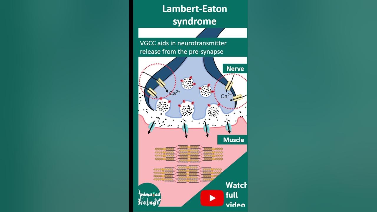 lambert-eaton-syndrome-proximal-muscle-weakness-1-minute-pathology