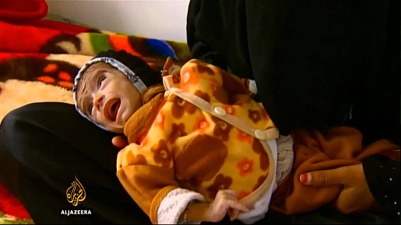 أطفال اليمن يواجهون المجاعة - قناة الجزيرة البلقان
