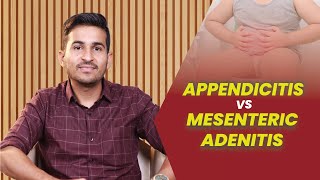 Appendicitis Vs Mesenteric Adenitis | Dr. B. Padam Kumar