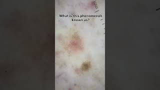 Look at this lesion