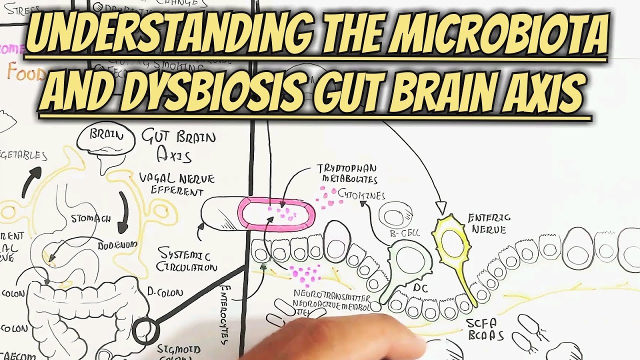 Understanding The Microbiota And Dysbiosis Gut Brain Axis ...