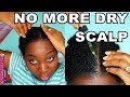 How to Moisturize Dry Scalp