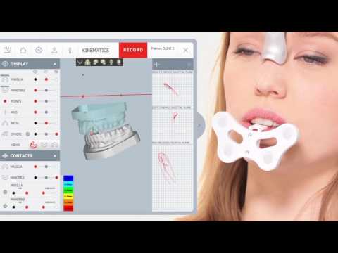 Modjaw  - 4D Jaw Motion  - The Digital Revolution CADCAM