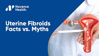 Uterine Fibroids Facts vs. Myths