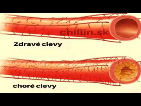 Video: Môže cesnak znížiť cholesterol?