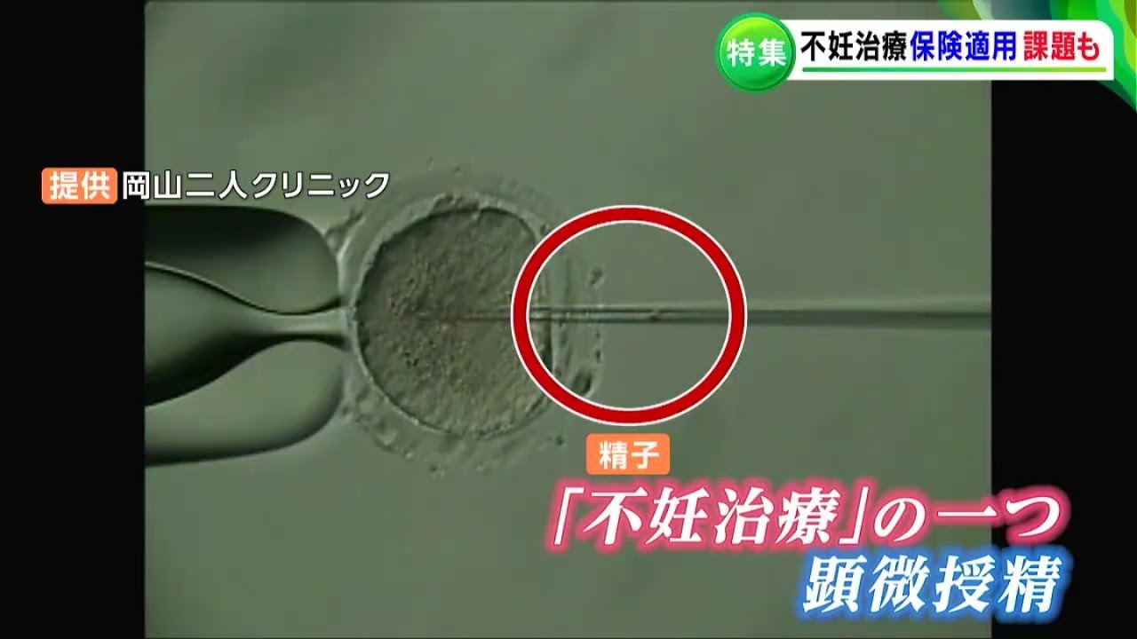 不妊治療の保険適用「体外受精の治療費は約58万円から約16万円に」「逆に治療費が高額になってしまうケースも・・・」