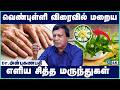வெண்புள்ளி மறைய | Venpulli starting stage | vitiligo skin disease treatment tamil | Cosmo View