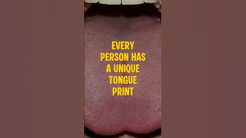Every Person Has a Unique Tongue Print
