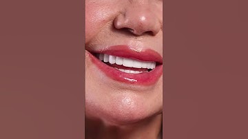 BẠN SẼ TRÔNG THẾ NÀO SAU KHI LÀM RĂNG SỨ?