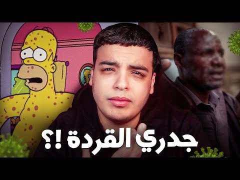 جدري القردة دخل المغرب