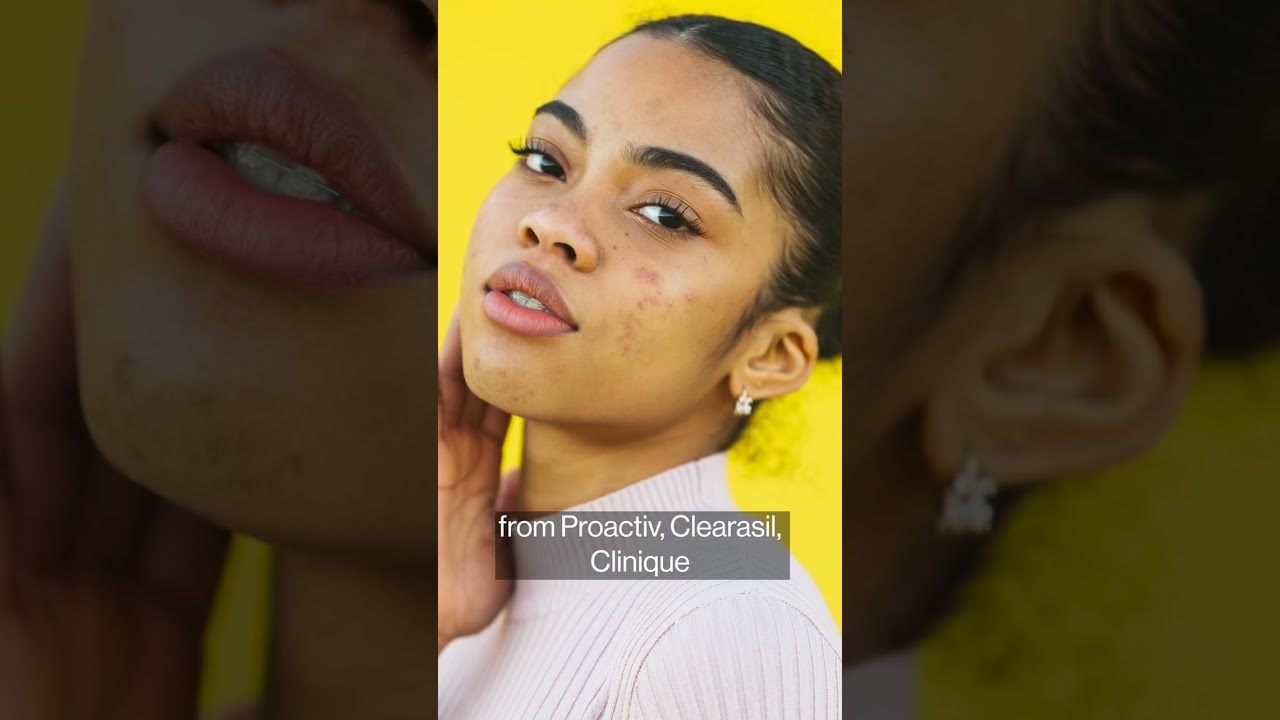 Is your acne cream safe to use?