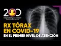 RX TORAX EN COVID 19