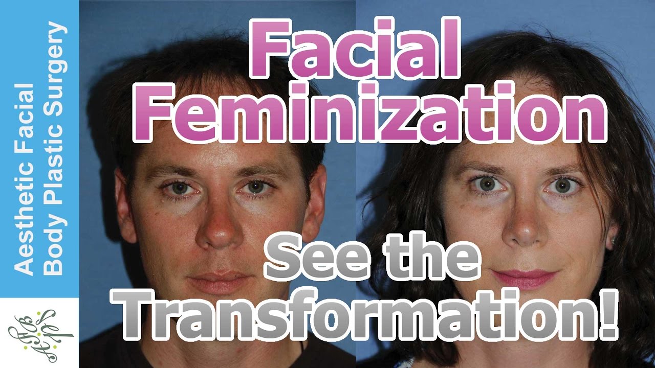 Transgender Facial Feminization Ffs Mtf M2f Plastic Surgery Video By