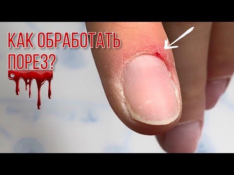 Видео: Как вылечить грибок ногтей (с иллюстрациями)