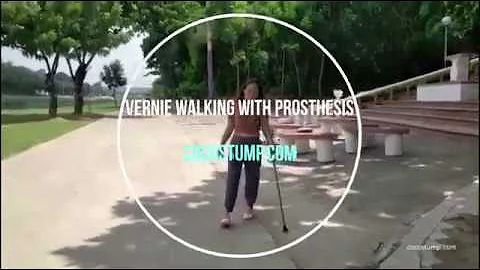 Vernie Walking With Prosthesis (RAK Amputee)