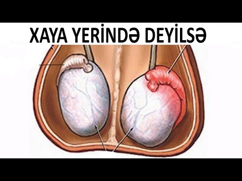 Video: Yuxarı çəkmək nədir?