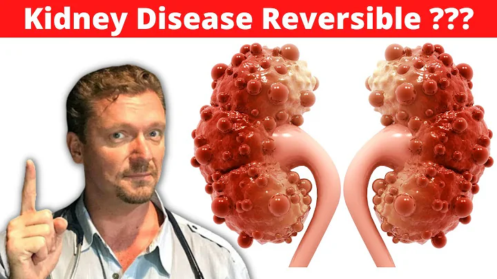 Reverse Chronic Kidney Disease (CKD) [Improve Kidney Function with Diet] 2024 - DayDayNews