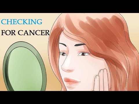 how-to-get-rid-of-brown-spots-using-home-remedies-|-checking-for-cancer