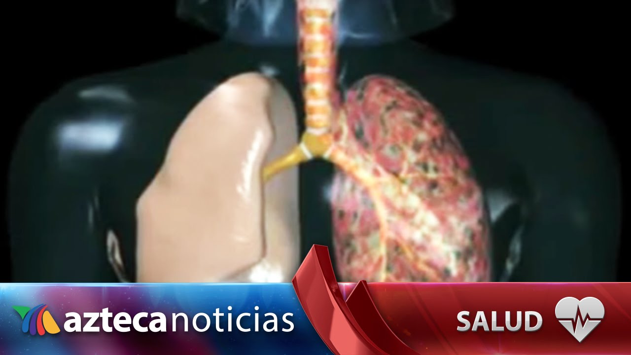 Si fumas adelgazar en