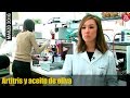 Artritis y aceite de oliva - Investigación en la Universidad de Sevilla