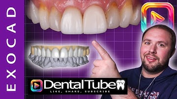 Exocad: Do you like your smile?