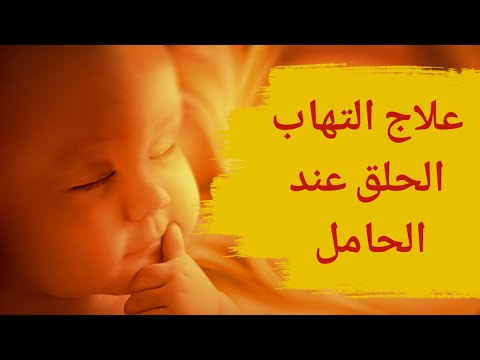 التهاب الحلق عند الحامل | 4 علاجات طبيعية للتخلص من التهاب الحلق عند الحامل