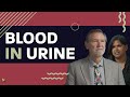 What Does Blood In The Urine Mean? | Prostate Expert, Mark Scholz, MD